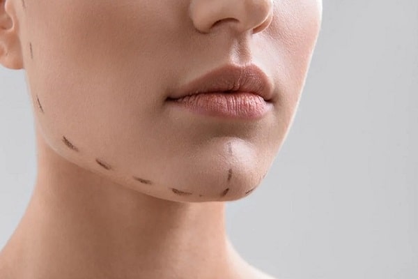 أفضل دکتور تجميل في قطر ؛ أهمية الرعاية بعد العملية الجراحية