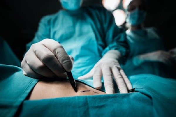 افضل دکتور تجمیل فی دبی ؛ Body Contouring
