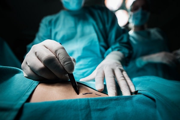 افضل مرکز تخسیس فی سلطنة عمان ؛ ربط المعدة القابل للتعديل (Gastric Banding)