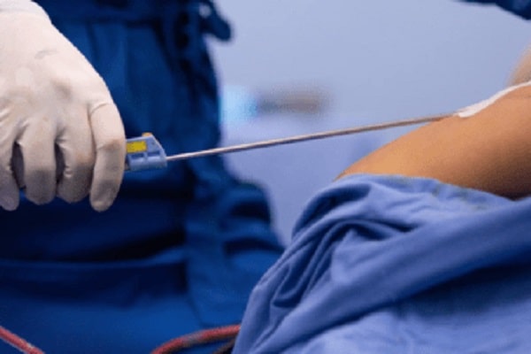 عیادات تجمیل فی قطر _ من هم الأشخاص المناسبون لإجراء شفط الدهون؟