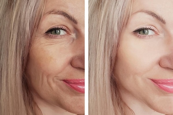 افضل مرکز تجمیل فی العراق ؛ من هم الأشخاص المناسبون لخدمات تجديد شباب البشرة؟ افضل مرکز تجمیل فی العراق ؛ من هم الأشخاص المناسبون لخدمات تجديد شباب البشرة؟