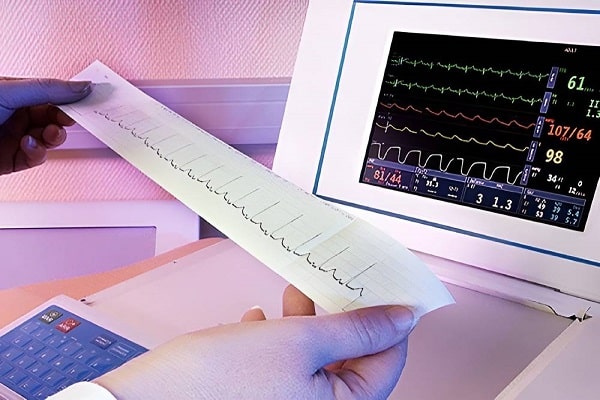 سعر عملیه تجمیل الانف فی العراق ؛ فحص القلب قبل الجراحة