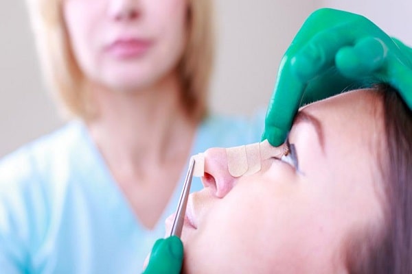 سعر عملية تجميل الأنف في العراق ؛ نمط الحياة قبل العملية