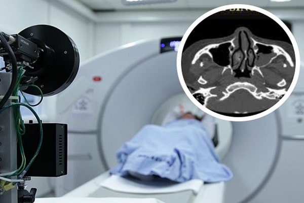 سعر عملية تجميل الأنف في العراق ؛ التصوير الطبي قبل الجراحة