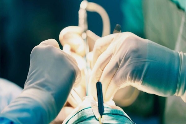 سعر عملية تجميل الأنف في العراق ؛ رينوبلاستي بريزيرفيشن