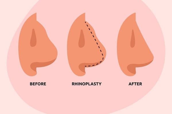 افضل دكتور تجميل في قطر ؛ جمالك وثقتك بنفسك